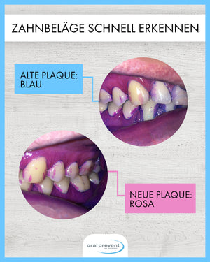 40x ORAL PREVENT Plaque Färbetabletten - Zahnfärbetabletten für Kinder/Erwachsene - Kautabletten - Zahnbelag einfärben - Erythrosinfrei
