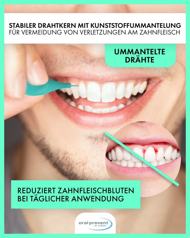 ORAL PREVENT Interdentalbürsten Smart Grip - Zahnreinigung für die Zwischenräume - Zahnzwischenraumbürste - Zahnstein-/Kariesprävention - 6er Beutel